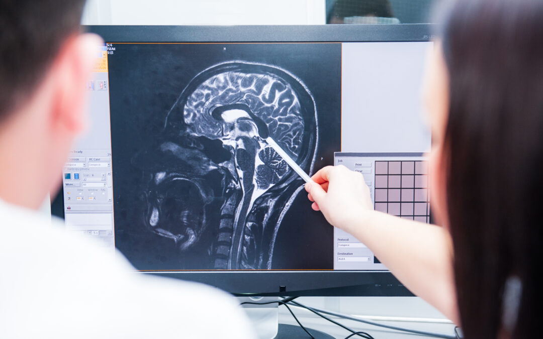 Doctors consider and discuss magnetic resonance image (MRI) of the brain. Back view, selective focus