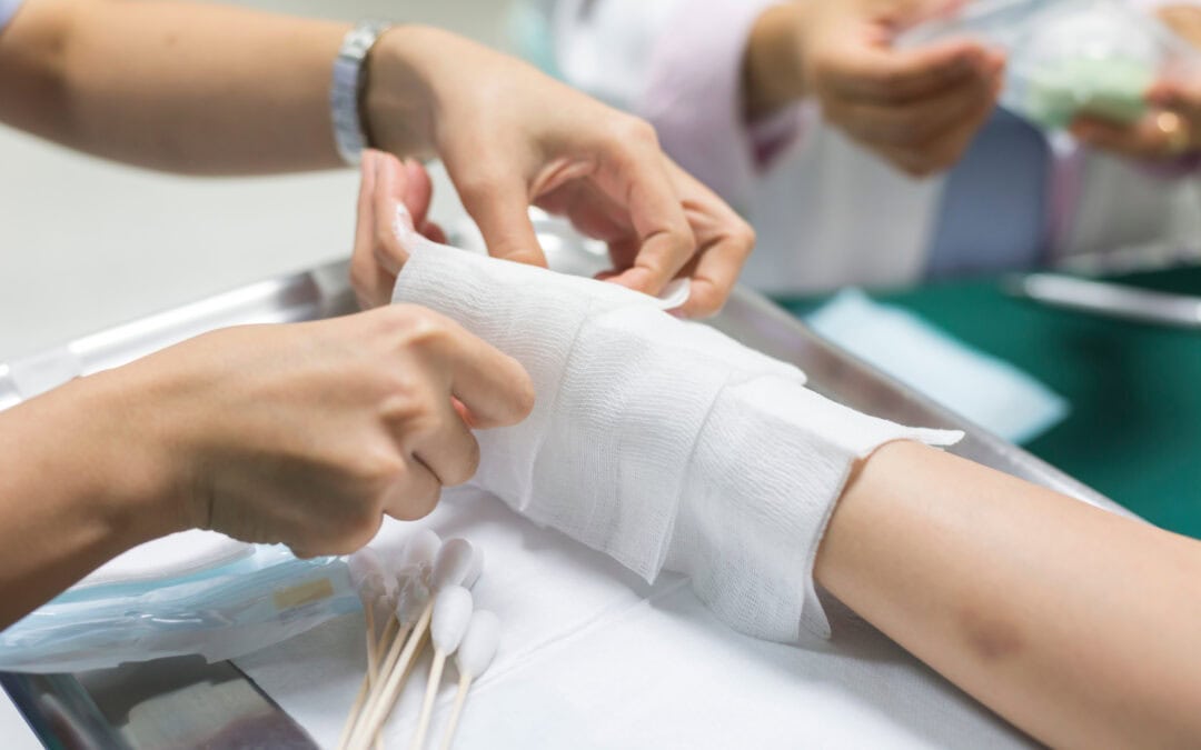 burn wound being dressed