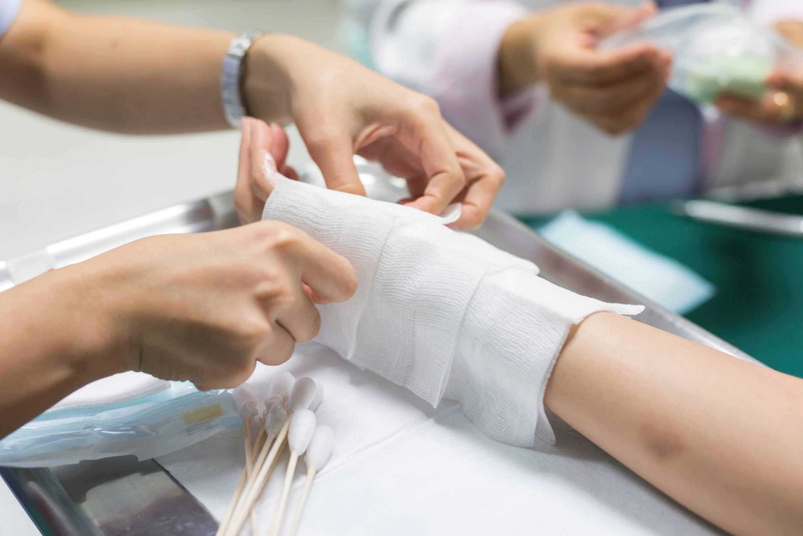 burn wound being dressed